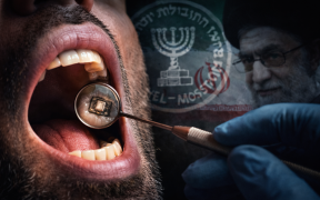 Espionage reflected in a dental mirror